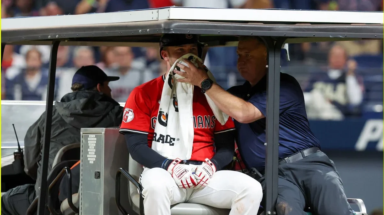 Guardians’ David Fry Hospitalized After Fastball to Face